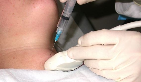 prelievi cotologici in ecografia Dr. Marino Lanza 